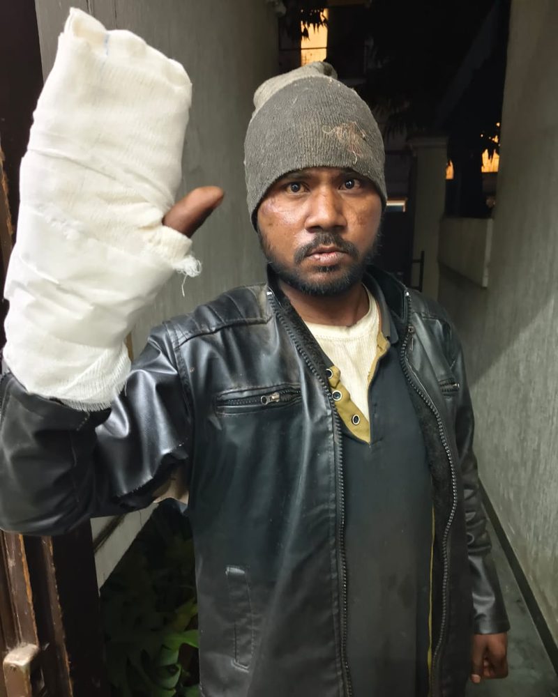 The same patient with his treated hand in a cast